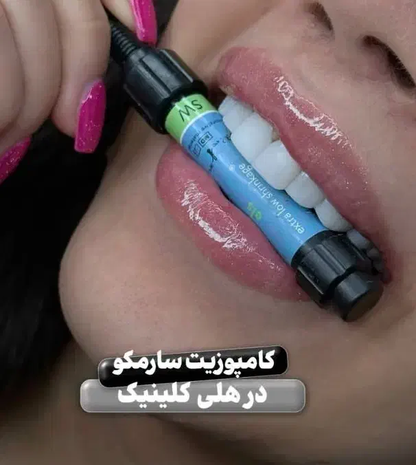 دندانپزشکی کامپوزیت فکی ۸ میلیون با ضمانت ده ساله|آرایشی، بهداشتی، درمانی|رشت, بازار|دیوار