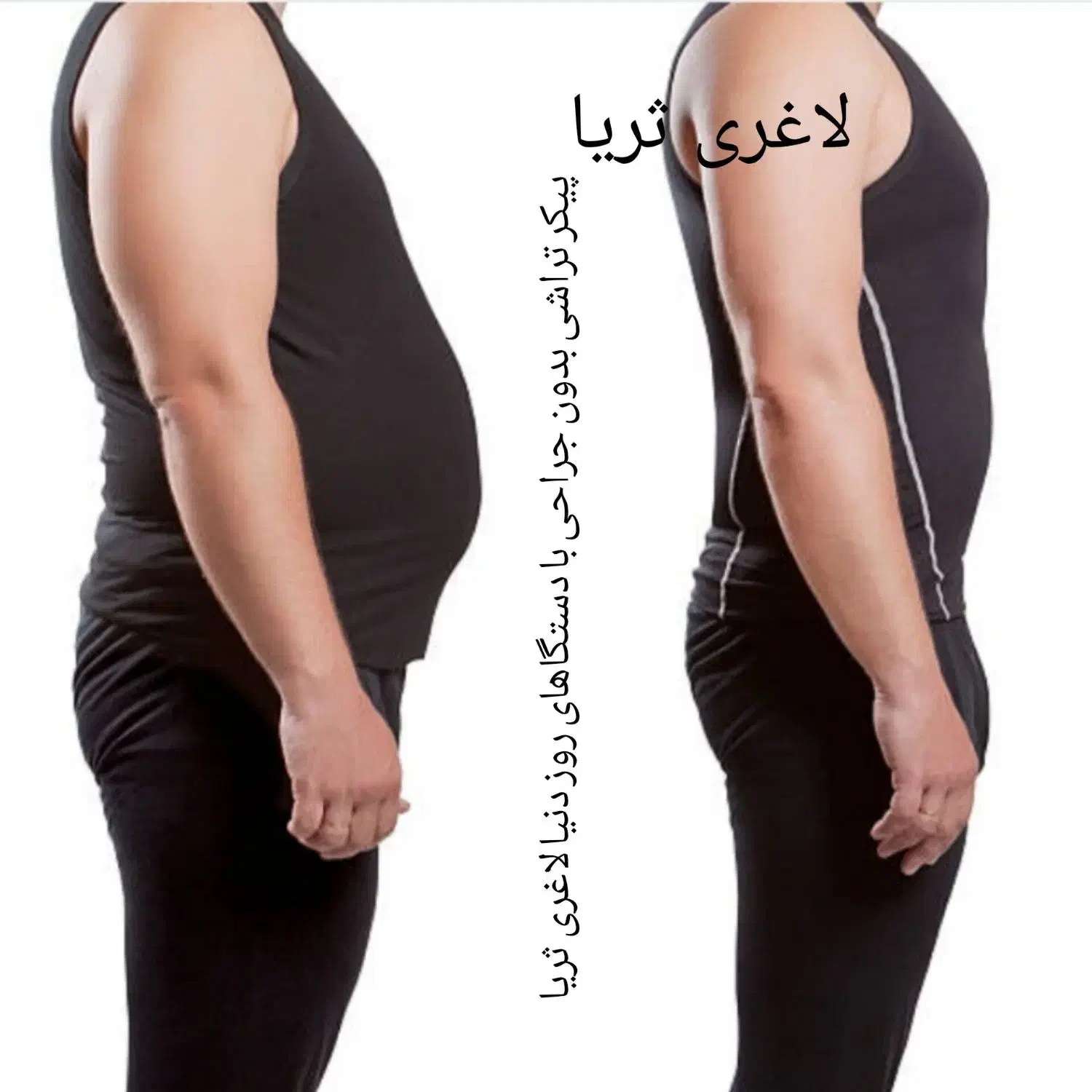 لاغری وپیکر تراشی بدون جراحی|خدمات آرایشگری و زیبایی|مشهد, چهارچشمه|دیوار