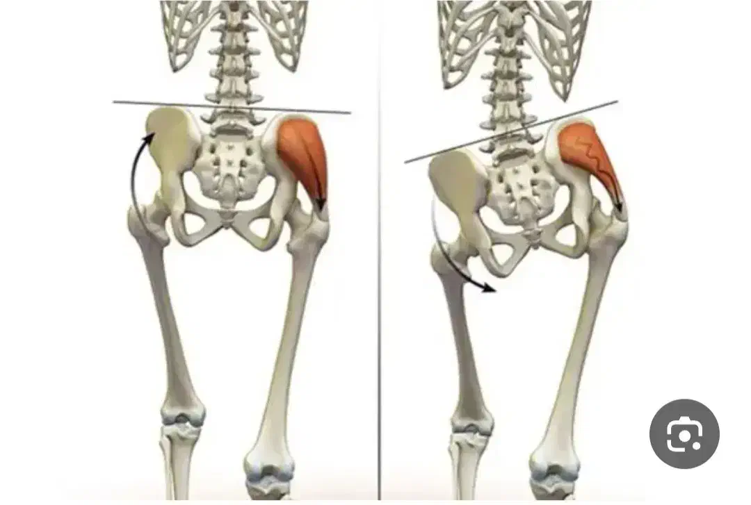 کلینیک ارتوپدی فنی قوز،گودی کمر،انحراف ستون فقرات|خدمات آرایشگری و زیبایی|فامنین, |دیوار