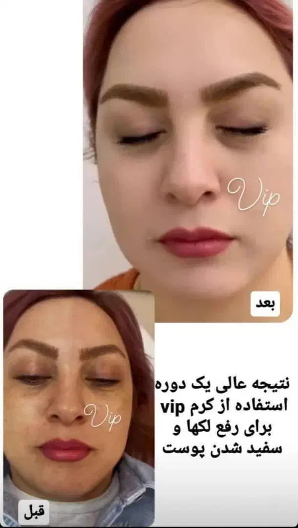 فرمول کرم سفید کننده قوی صورت ودستوپا تضمینی|آرایشی، بهداشتی، درمانی|ایرانشهر, |دیوار