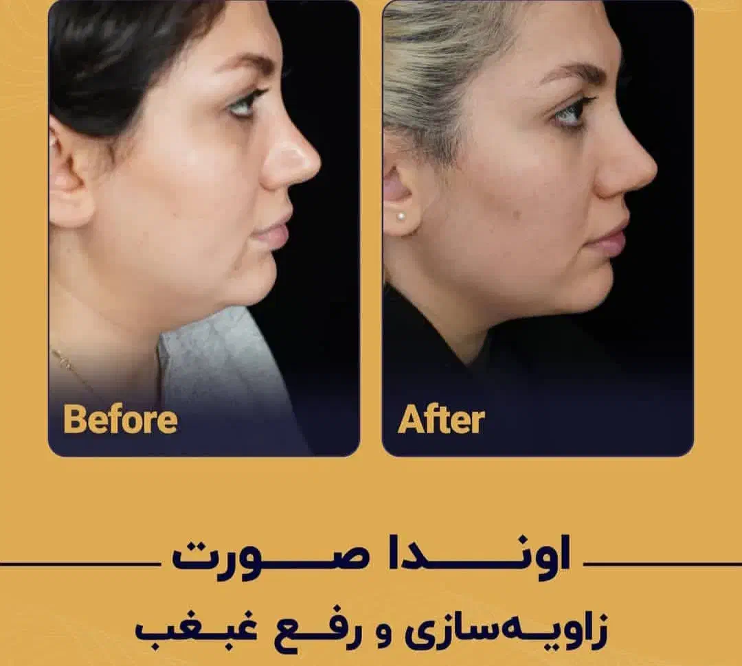 تناسب اندام|خدمات آرایشگری و زیبایی|نجفآباد, امام خمینی|دیوار