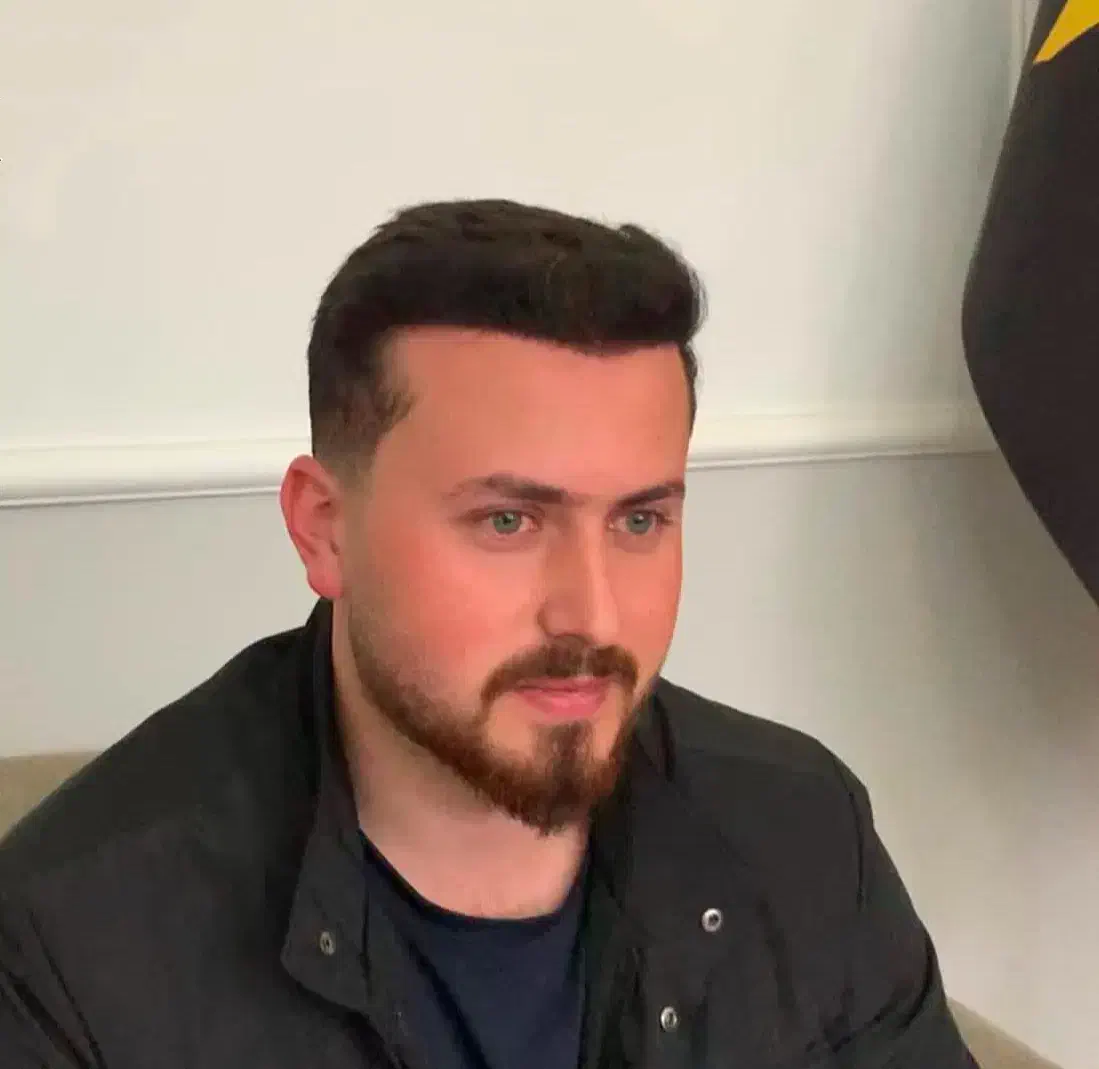 کاشت مو تبریزقیمت مناسب اقساطی فول تراکم|خدمات آرایشگری و زیبایی|صوفیان, |دیوار