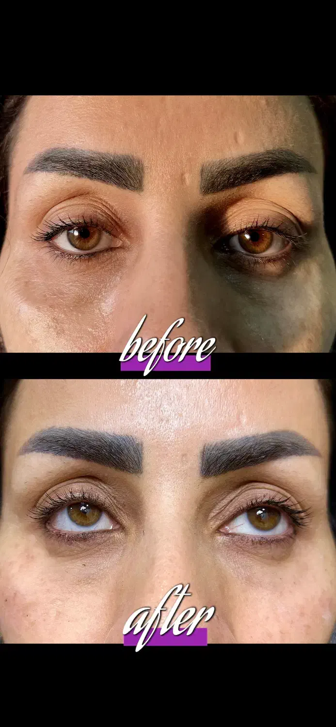 تزریقات فیلر و بوتاکس توسط پزشک|خدمات آرایشگری و زیبایی|تهران, جوادیه|دیوار