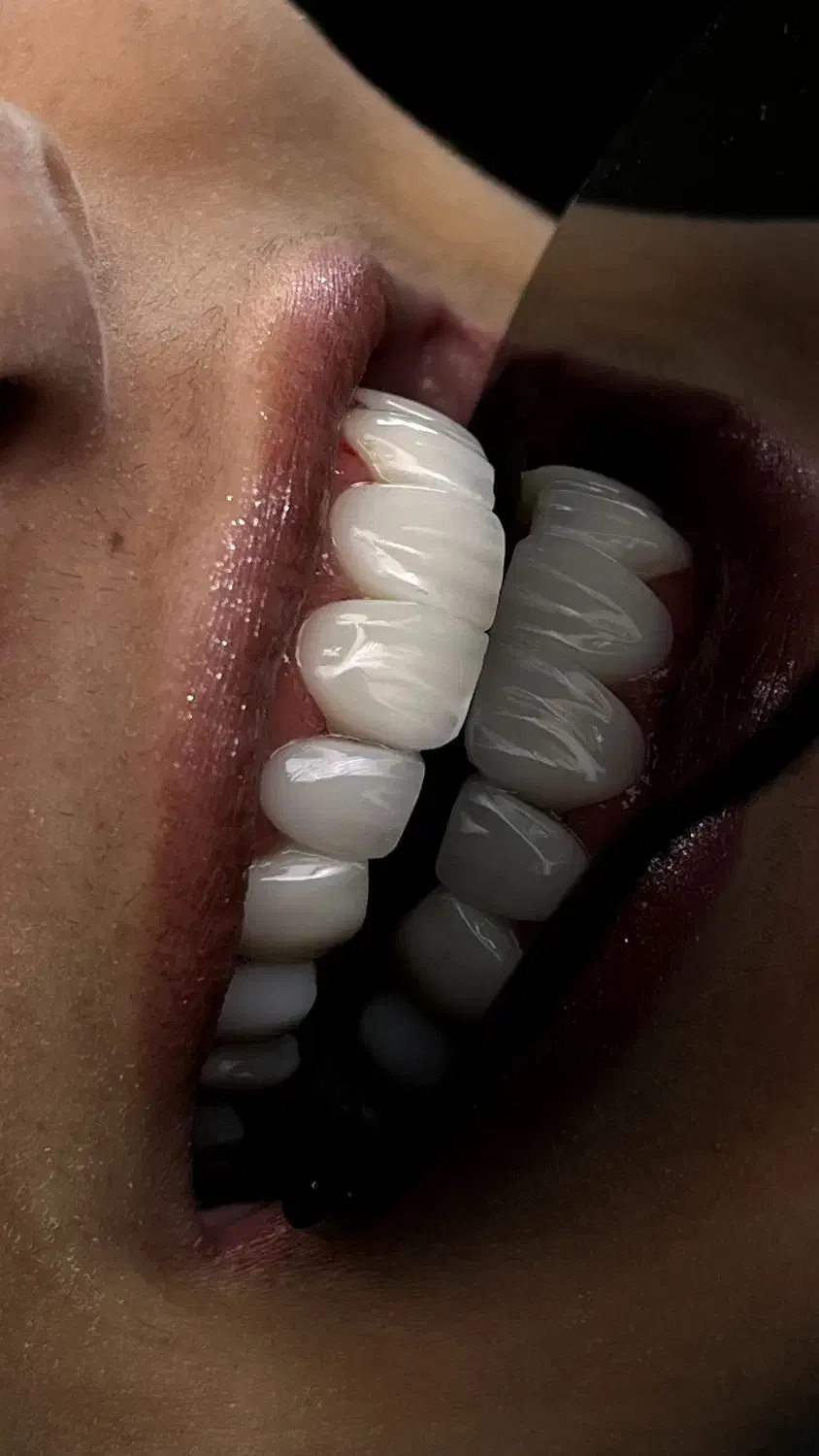 مدل کامپوزیت لیرینگ|خدمات آرایشگری و زیبایی|تهران, اباذر|دیوار