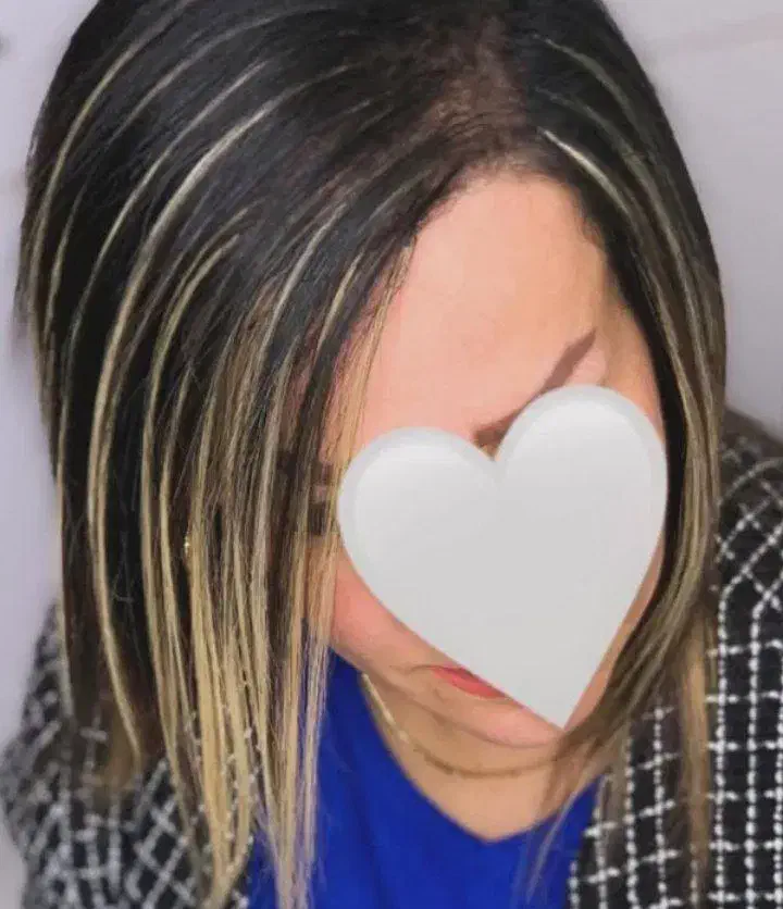 مو لیزری|حراج|ملایر, |دیوار