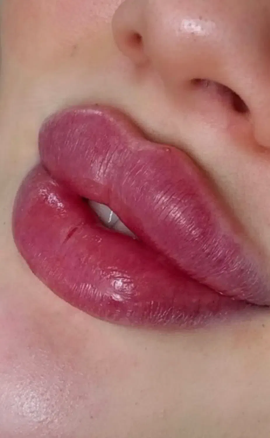 تزریق ژل وجوانسازی تخصصی ومزو ژل،بوتاکس|خدمات آرایشگری و زیبایی|شاهین‌شهر, فردوسی|دیوار