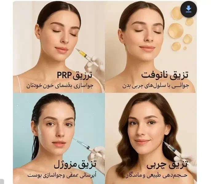 جشنواره تزریقات ژل وچربی وزیبایی دکتر مهرانادرشرق|خدمات آرایشگری و زیبایی|تهران, نیروی هوایی (پیروزی)|دیوار