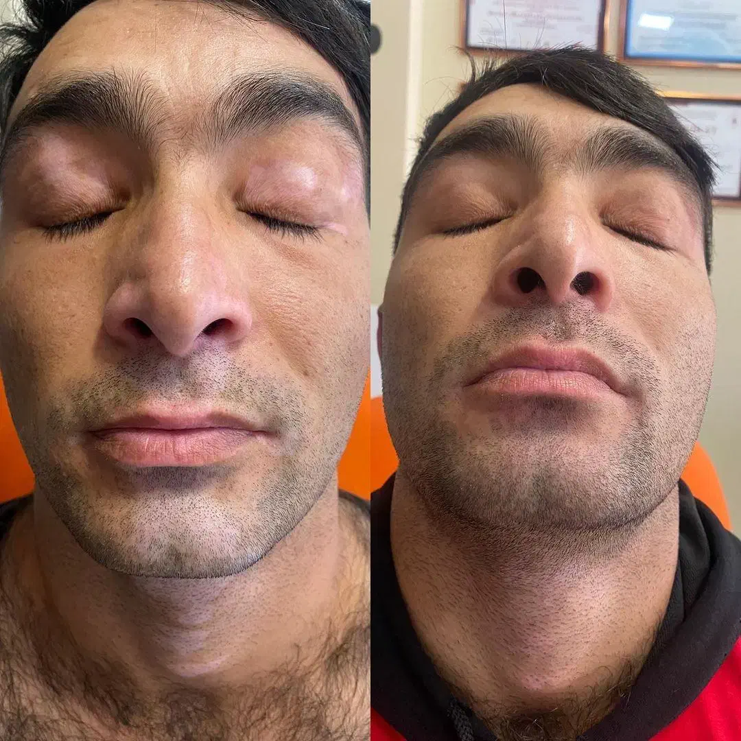 درمان ریشه ای و بدون بازگشت پیسی و پسوریازیس|آرایشی، بهداشتی، درمانی|شیراز, حافظیه|دیوار