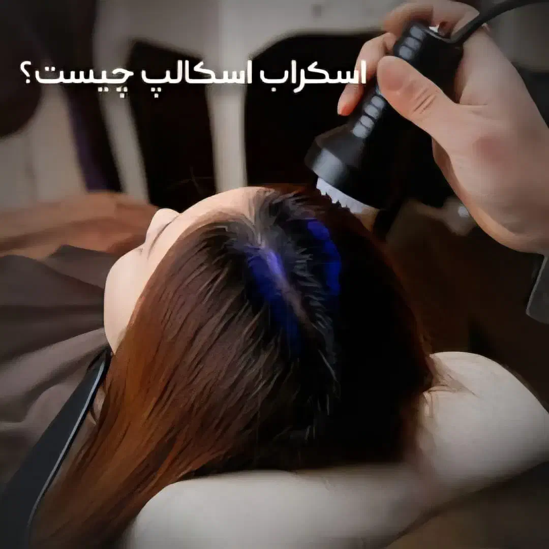 اسکراب اسکالپ کف سر|خدمات آرایشگری و زیبایی|اهواز, کیانپارس |دیوار