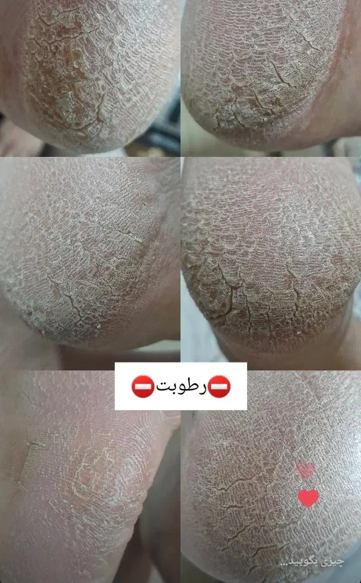 فقط برای بانوان تصاویر با دقت ببینید|خدمات آرایشگری و زیبایی|کوهدشت, |دیوار