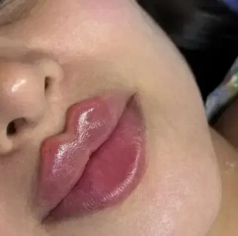 تزریق ژل فقط سیسی ۸۰۰بمدت سه روز|خدمات آرایشگری و زیبایی|زاهدان, |دیوار