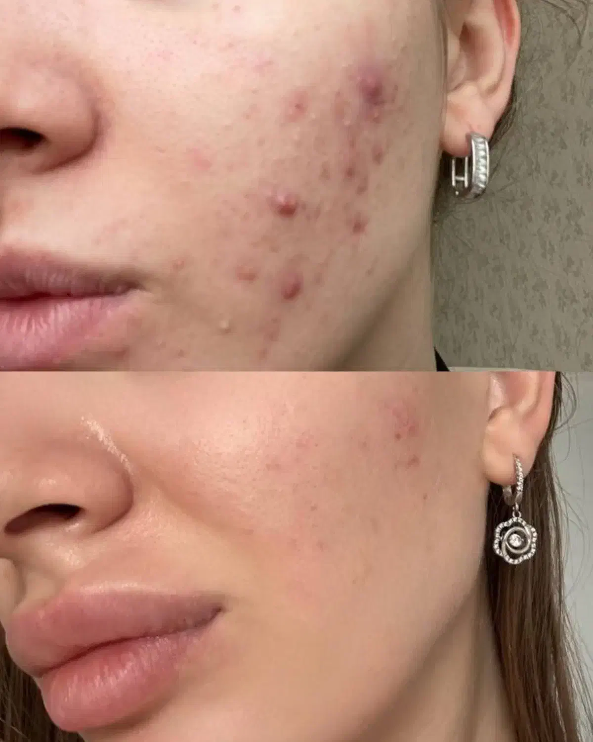 آموزش تخصصی فیشال و پاکسازی پوست از صفر تا حرفهای|خدمات آموزشی|ارومیه, |دیوار