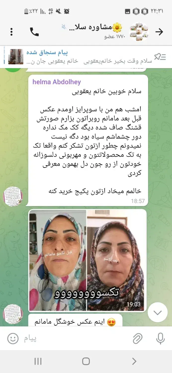 پوستت هلوی با تکسو|خدمات آرایشگری و زیبایی|کرمان, |دیوار