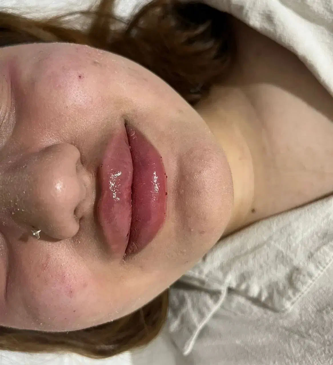 فیلر(ژل)و بوتاکس|خدمات آرایشگری و زیبایی|سهند, |دیوار