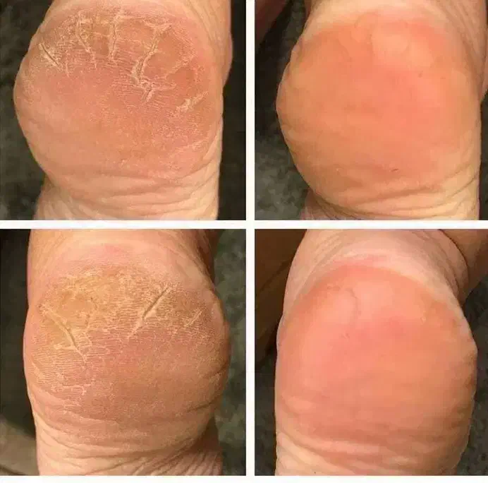 آموزش/پدیکور/کفسابی/درمان|خدمات آموزشی|کرج, اتحاد|دیوار