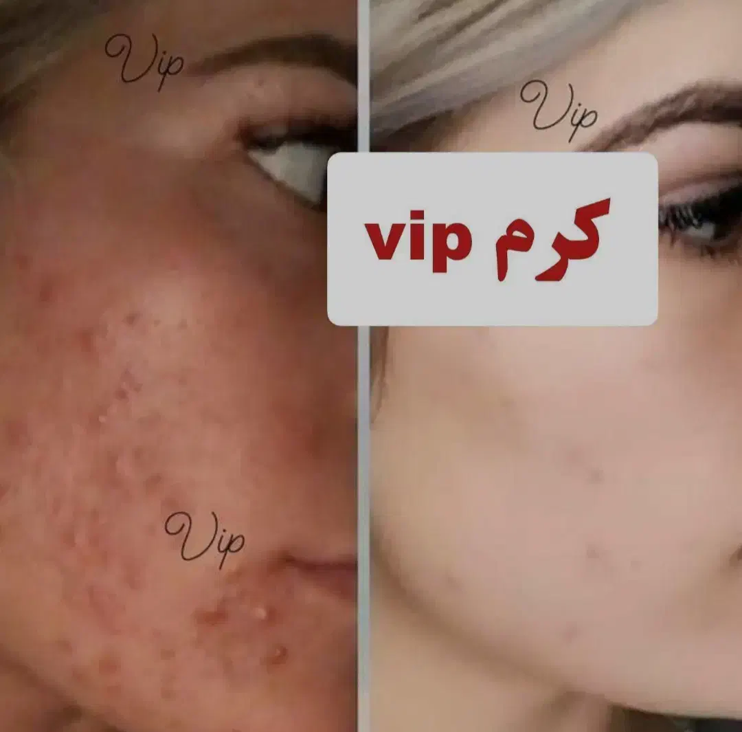 کرمvip|آرایشی، بهداشتی، درمانی|زابل, |دیوار