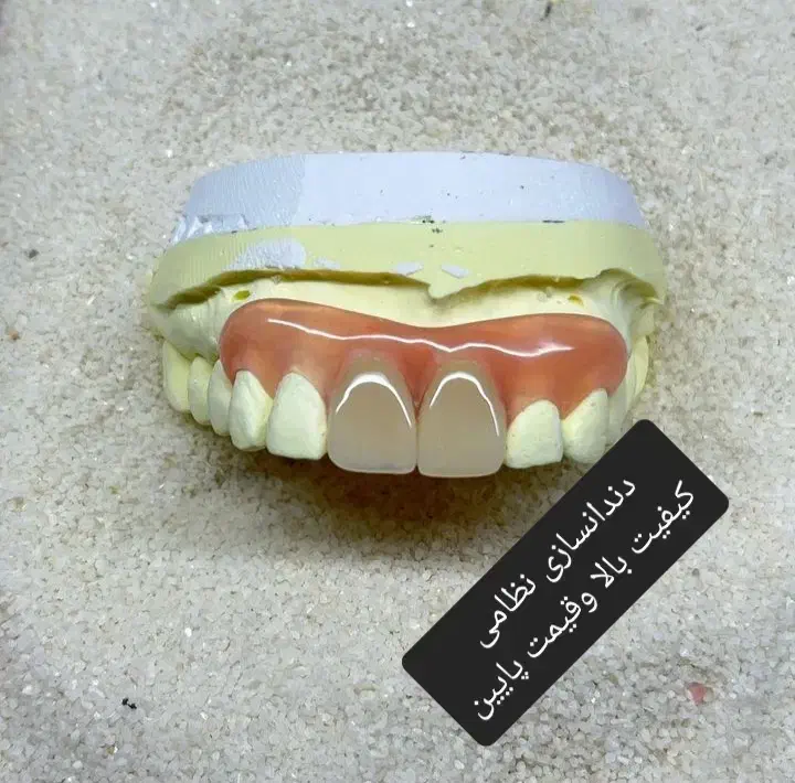 ساخت دندان مصنوعی سرامیکی دریک روز|آرایشی، بهداشتی، درمانی|زابل, |دیوار