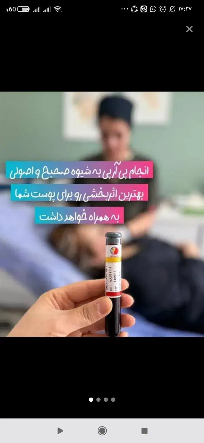 جشنواره تخفیف ویژه تزریق ژل و بوتاکس|خدمات آرایشگری و زیبایی|اصفهان, بوستان آینه خانه|دیوار