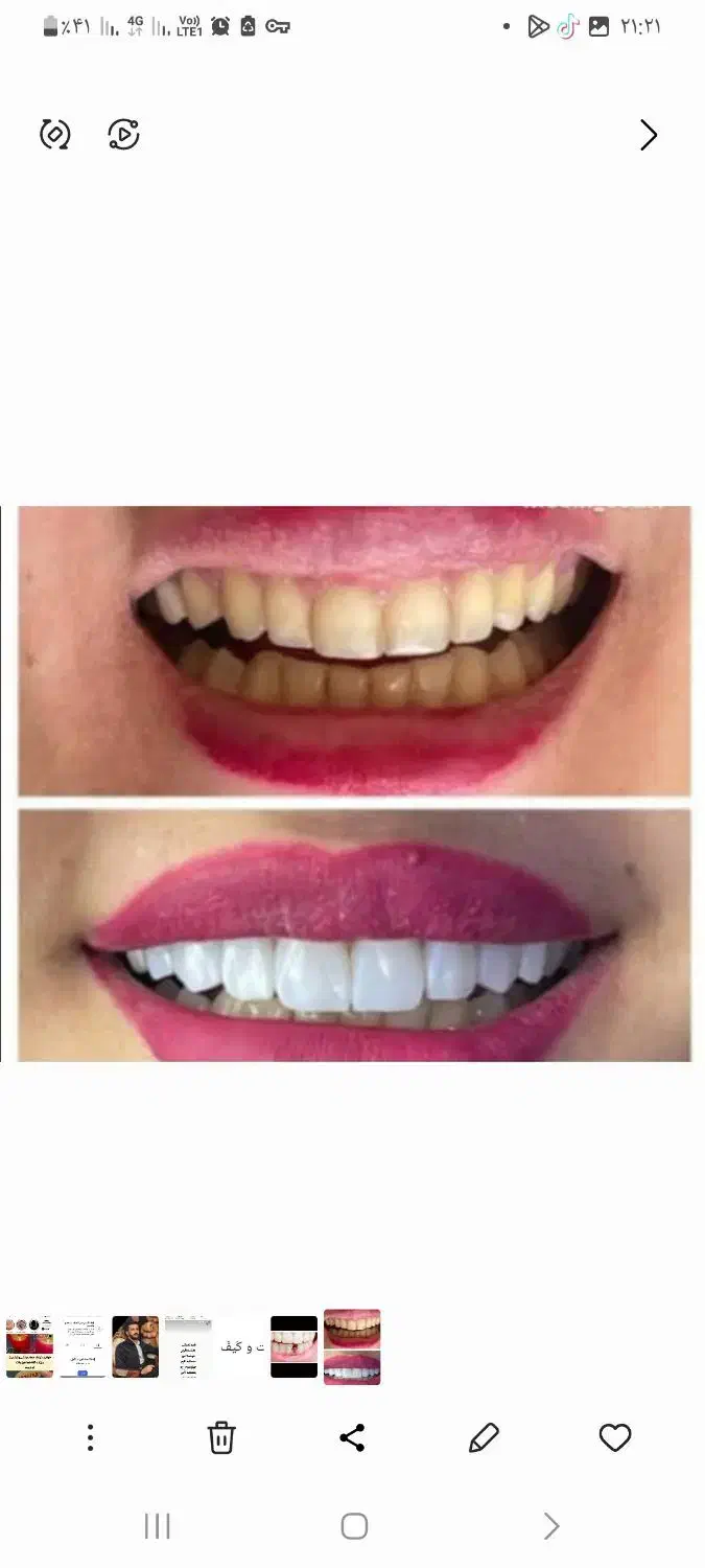 دندان پزشکی.بهترین و ارزانترین|خدمات آرایشگری و زیبایی|کرمانشاه, |دیوار