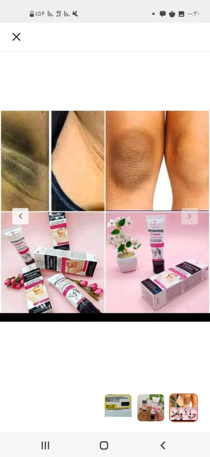 سفید کننده قطعی نقاط حساس بدن|آرایشی، بهداشتی، درمانی|قوچان, |دیوار