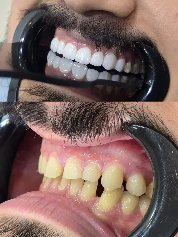 جشنواره دندانپزشکی اقساطی بدون پیش پرداخت|خدمات آرایشگری و زیبایی|شیراز, ستارخان|دیوار