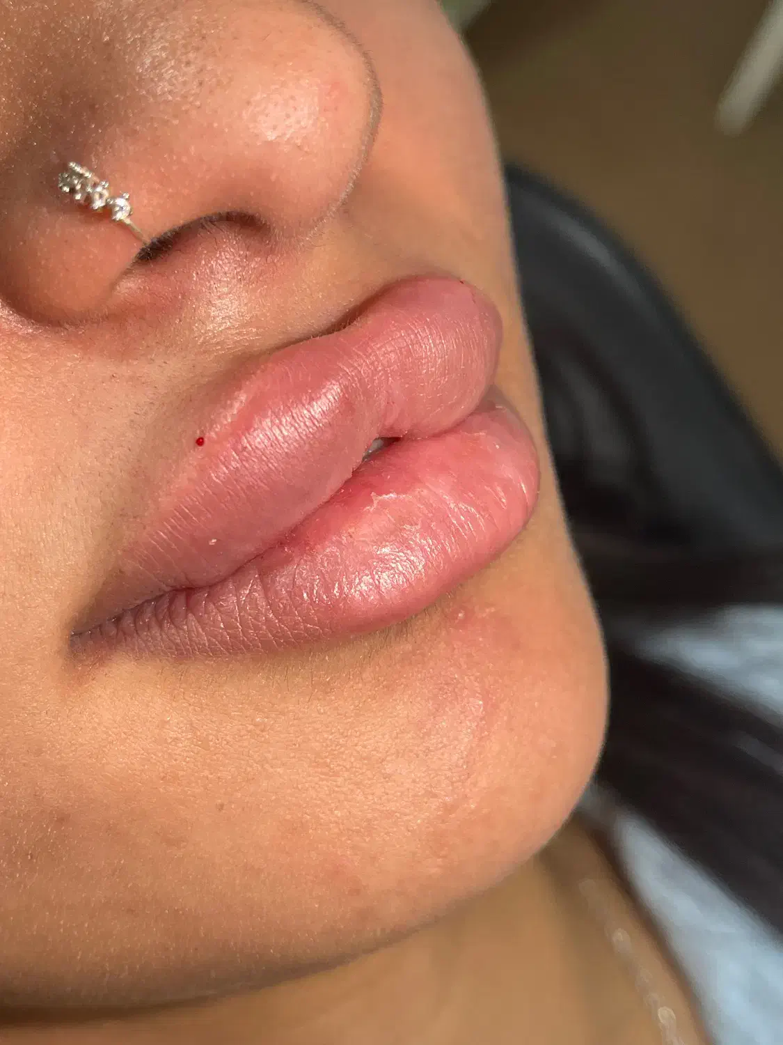 خدمات ژل و بوتاکس|خدمات آرایشگری و زیبایی|ساری, |دیوار