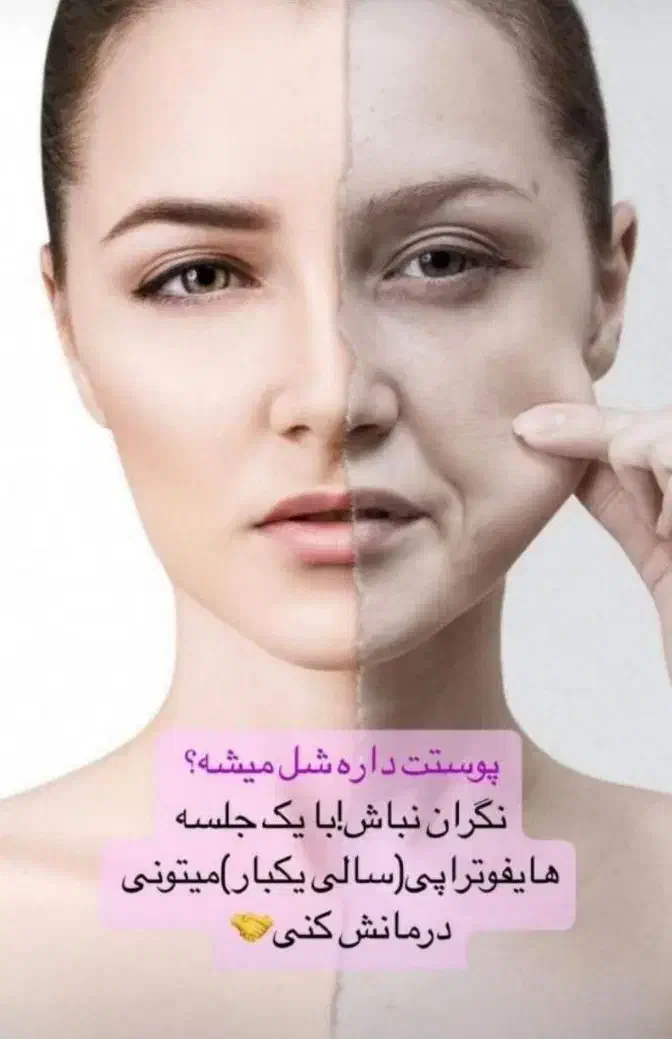 هایفوتراپی،رفع غبغب،لیزر،امبدینگ لاغری،prp|خدمات آرایشگری و زیبایی|سیرجان, |دیوار