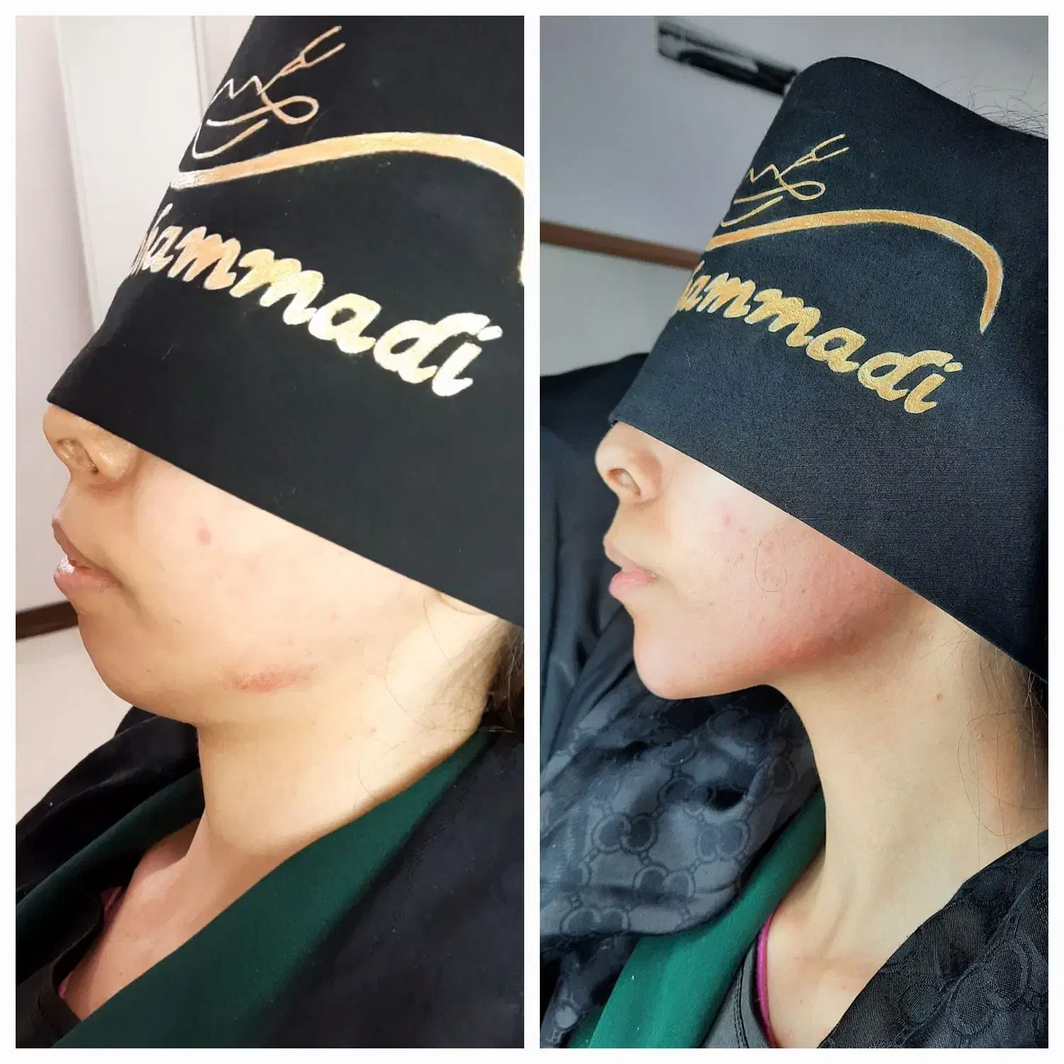 جشنواره یلدایی دکتر نفیسه پور محمدی|خدمات آرایشگری و زیبایی|قم, نیروگاه|دیوار