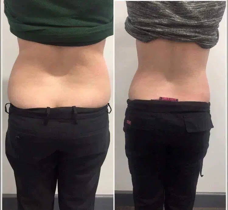 لاغری در شرق تهران (کلینیک تخصصی آرانا)|خدمات آرایشگری و زیبایی|تهران, هروی|دیوار