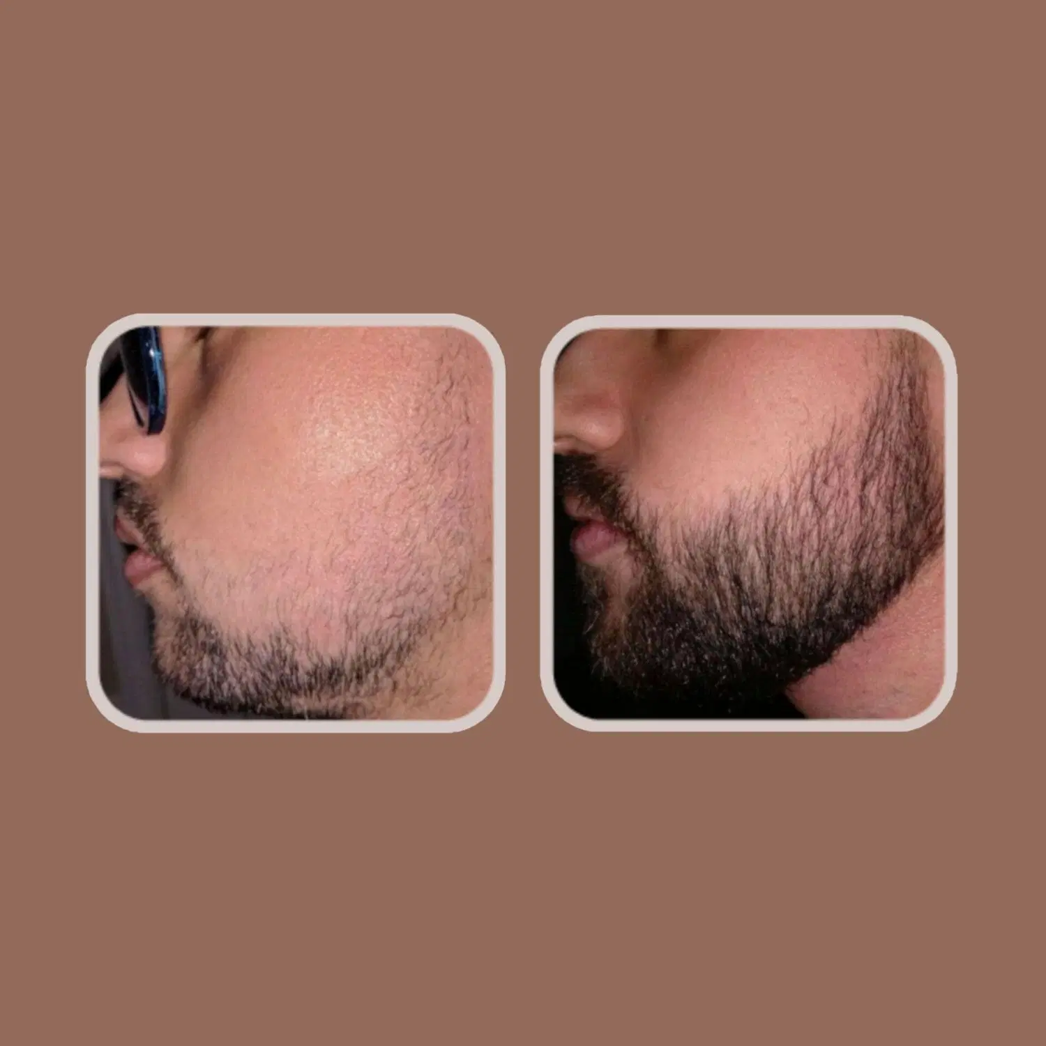 طی 25روز|آرایشی، بهداشتی، درمانی|فارسان, |دیوار