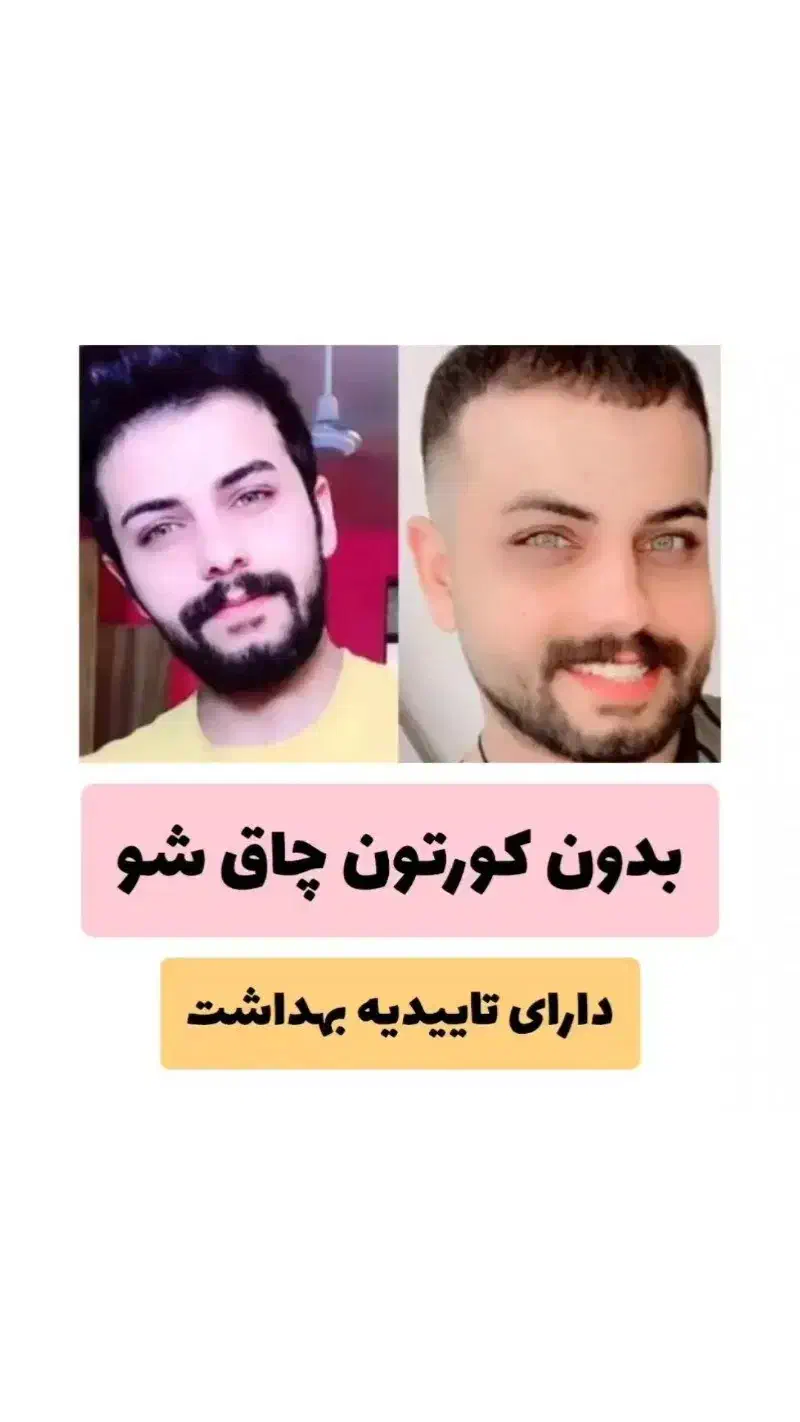 با جوانهگندم بین استار زیبا و تپل شو|حراج|شاهرود, |دیوار