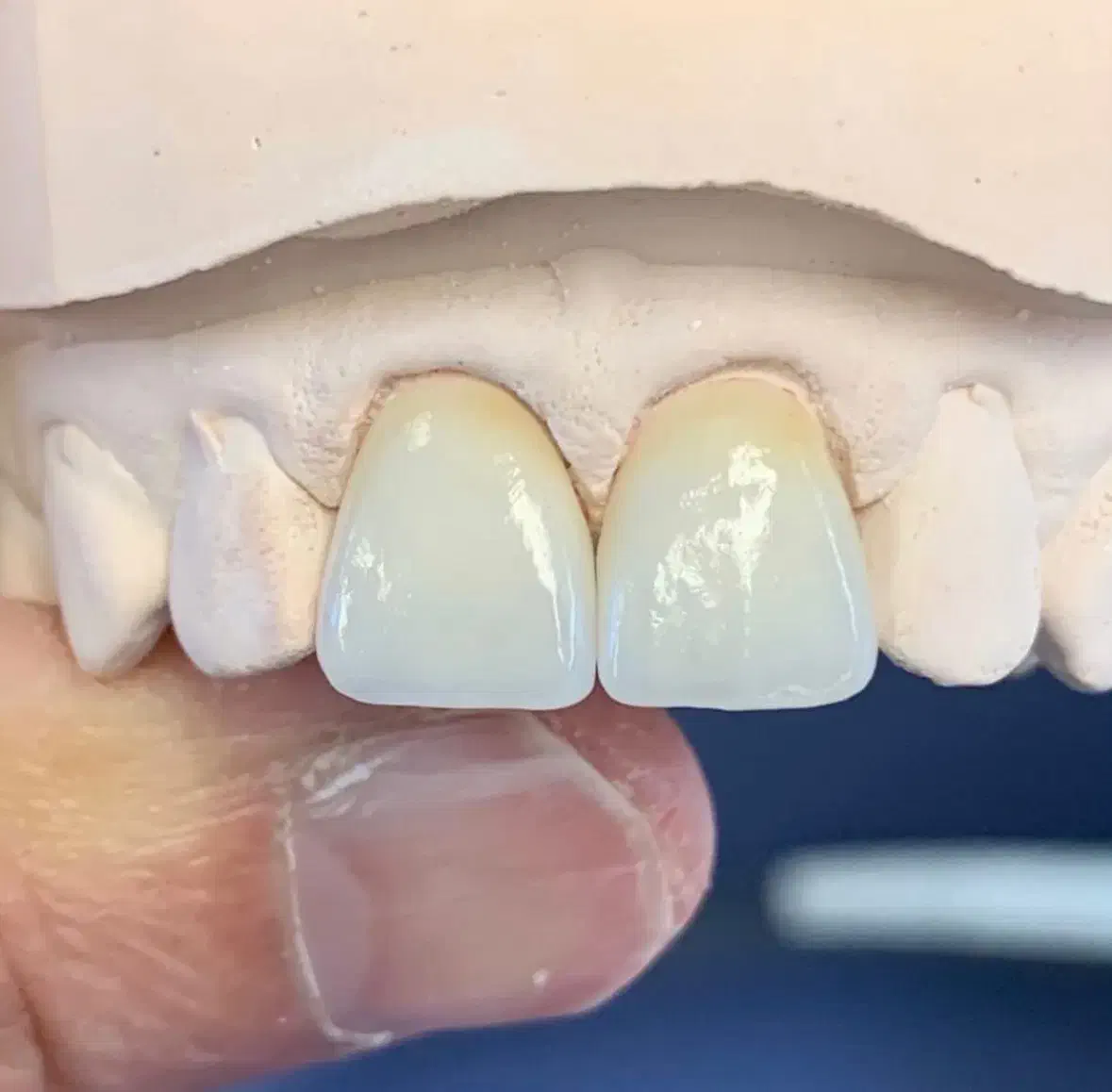 آموزش دندانسازی|استخدام آموزشی|تبریز, |دیوار