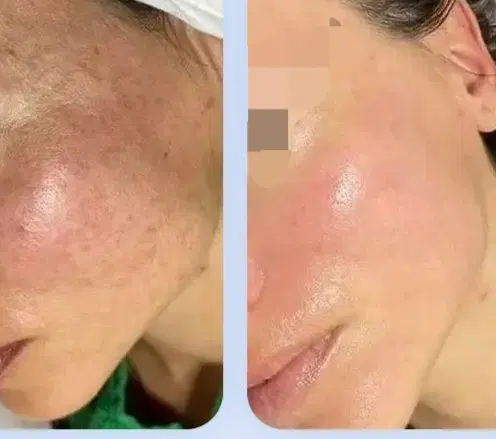 فیشیال|خدمات آرایشگری و زیبایی|الیگودرز, |دیوار