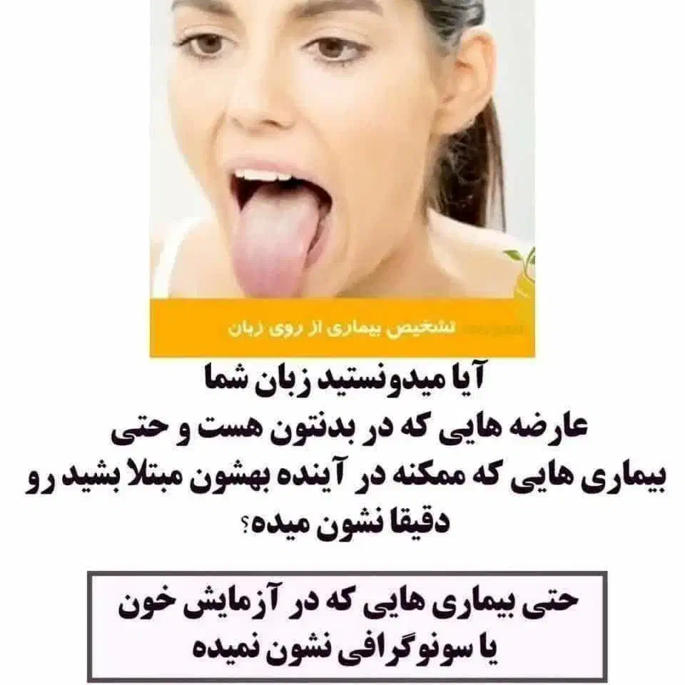 زبان شناسی|فعالیت داوطلبانه|اهواز, اسماعیلیه|دیوار