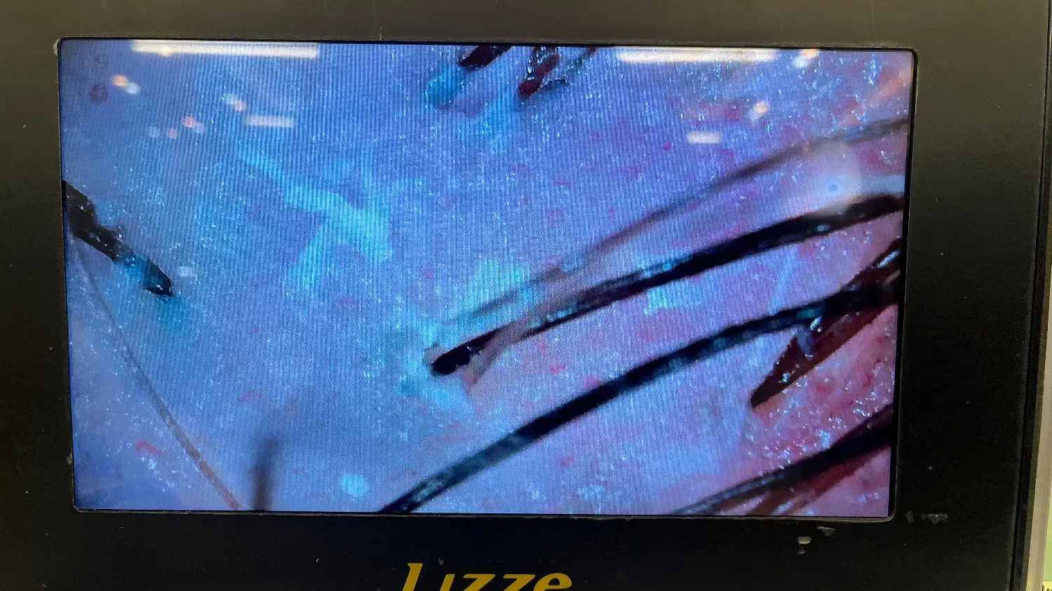 اموزش تخصصی لاین اسکراپ اسکالپ|خدمات آموزشی|اصفهان, خانه اصفهان|دیوار