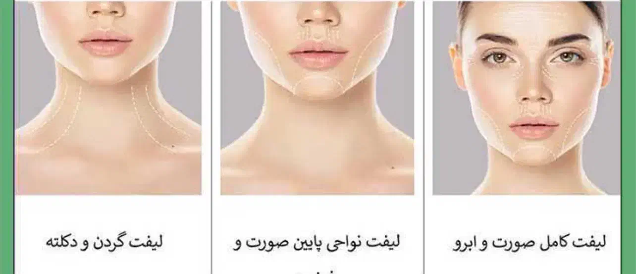 هایفو تراپی صورت شب یلدا|خدمات آرایشگری و زیبایی|سیرجان, |دیوار