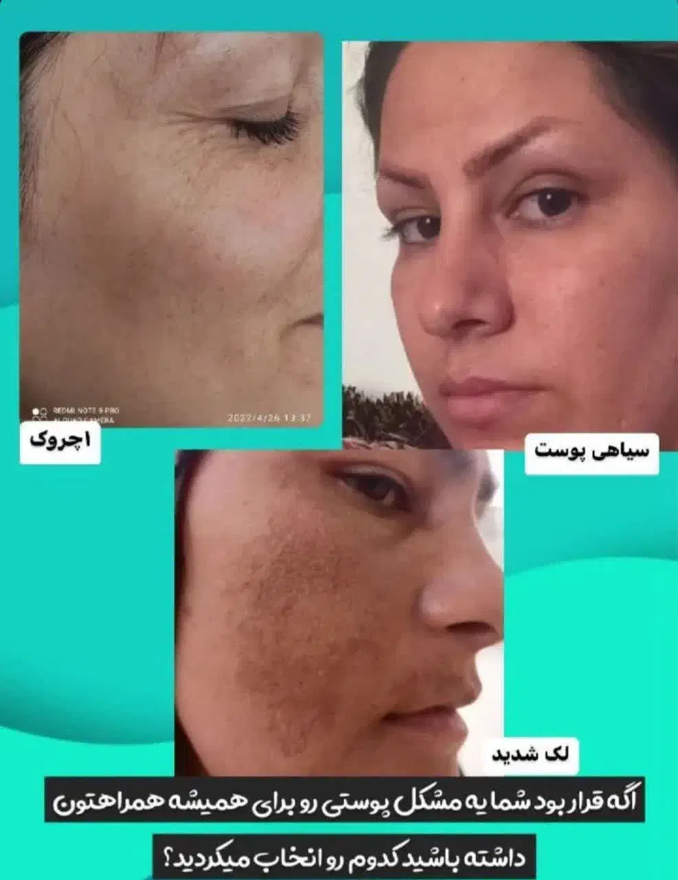 نمایندگی رویال دریاسوج ببرراضی نبودی پس میگیریم|آرایشی، بهداشتی، درمانی|دوگنبدان, |دیوار