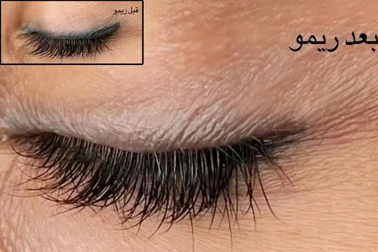 پاک کردن تاتوقدیمی ابرو دریک مرحله تضمینی با رجوی|خدمات آرایشگری و زیبایی|شوشتر, |دیوار