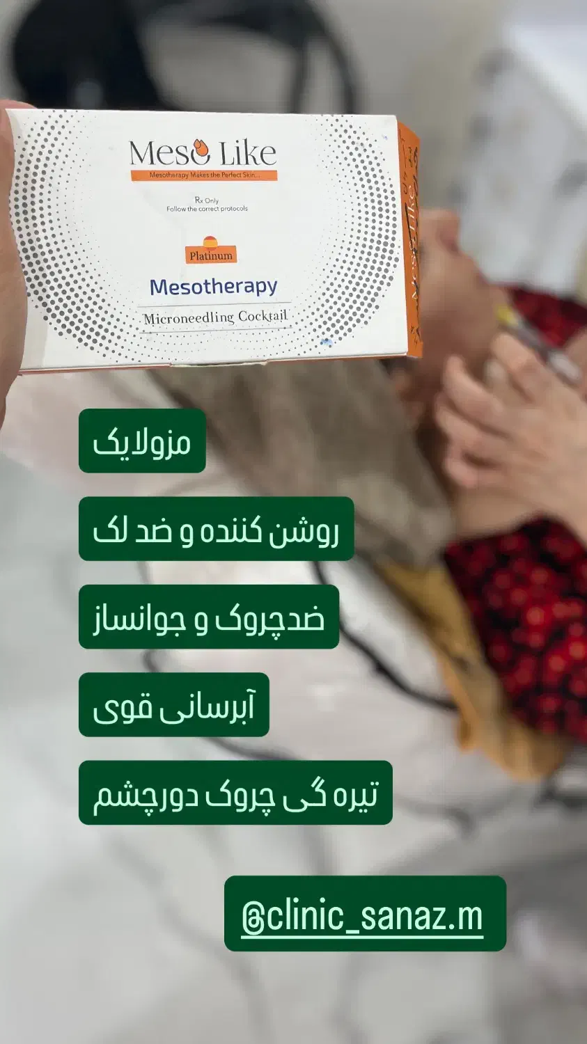 تخفیف ویژه ژل وبوتاکس|خدمات آرایشگری و زیبایی|ایذه, |دیوار