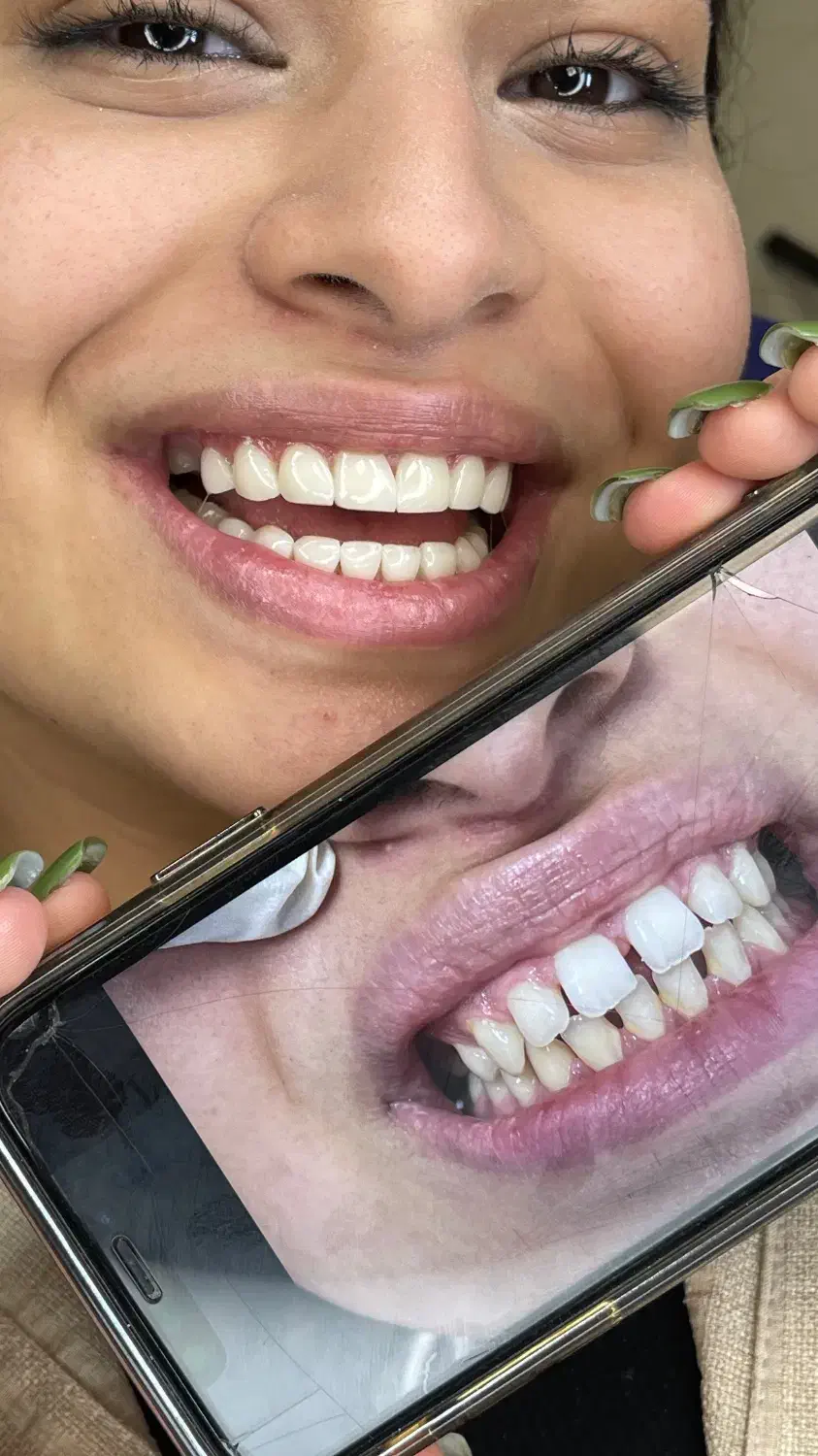 دندانپزشکی زیبایی جشنواره 50 درصدی با ضمانت|خدمات آرایشگری و زیبایی|تهران, نیاوران|دیوار