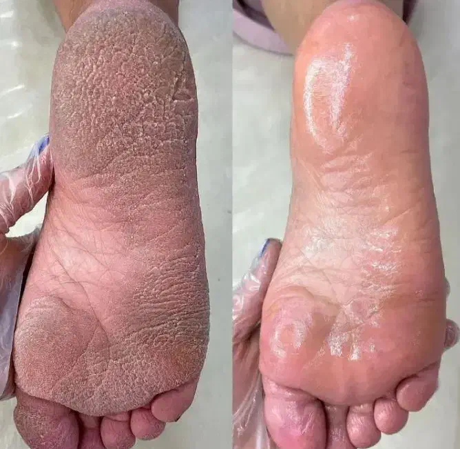 پدیکورتخصصی350آموزش پدیکور پاکسازی دست نوبهار|خدمات آرایشگری و زیبایی|کرمانشاه, |دیوار