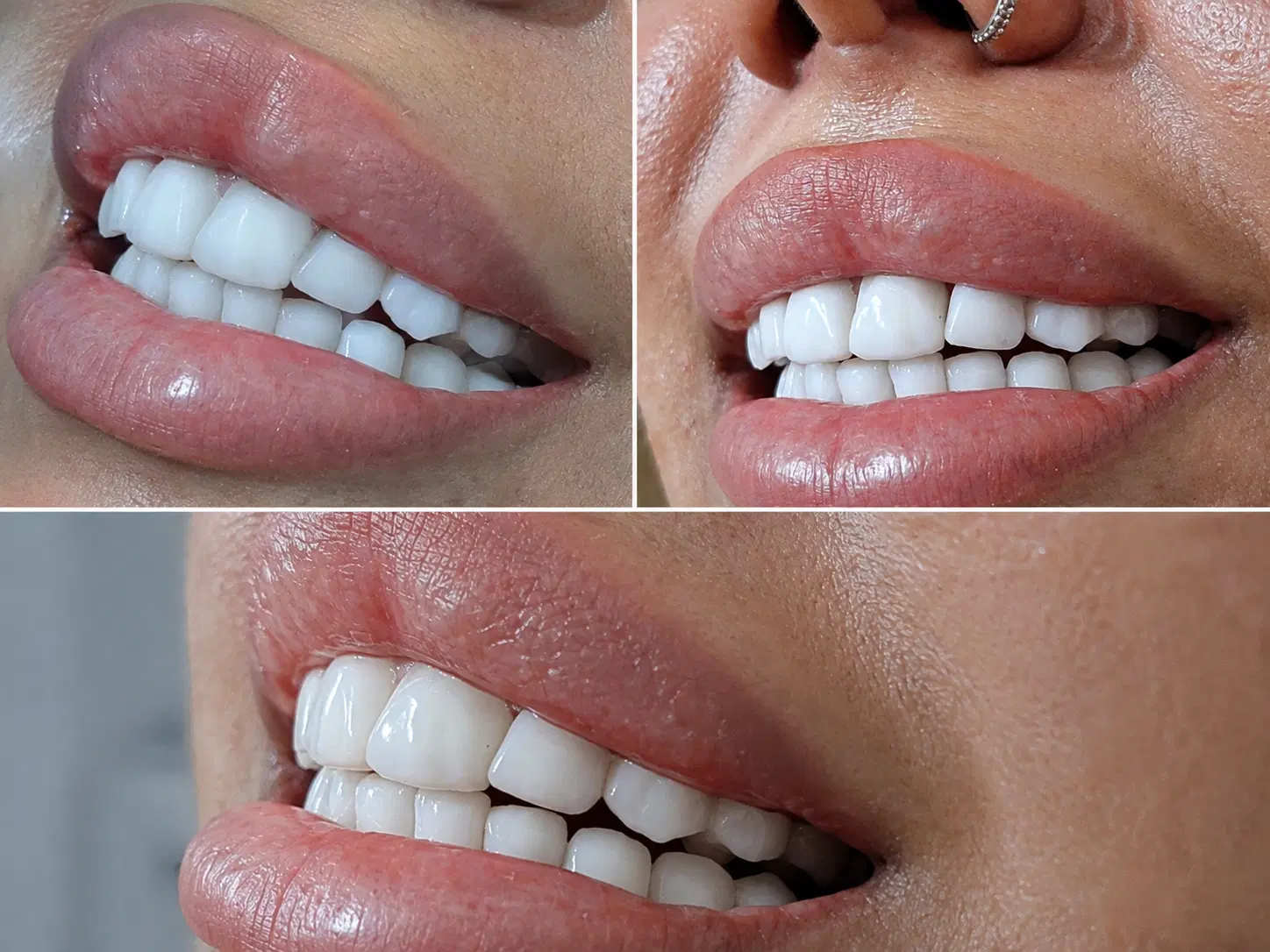 لابراتوار دندان،ساخت تخصصی روکش دندان|خدمات زیبایی و سلامت|تبریز, |دیوار