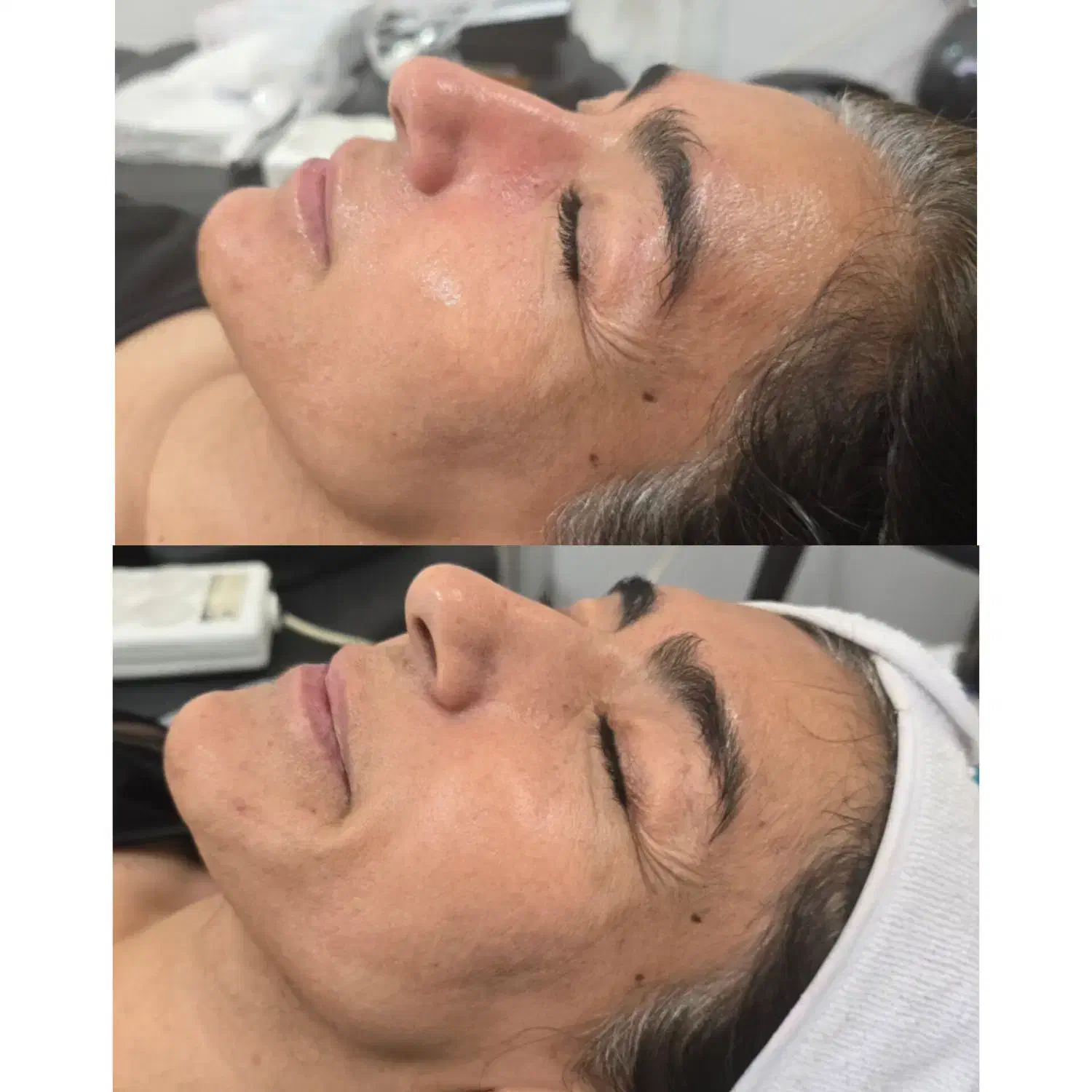 پاکسازی پوست/فشیال تخصصی|خدمات آرایشگری و زیبایی|شیراز, شهرک فرزانگان|دیوار