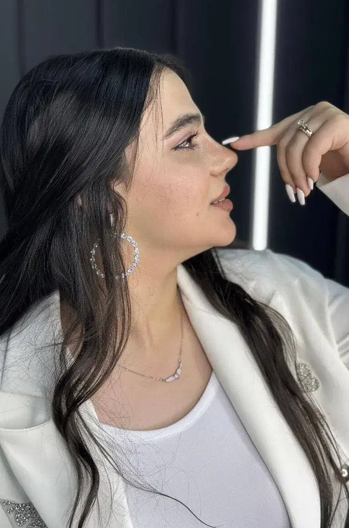 عمل بینی/جراحی بینی|خدمات آرایشگری و زیبایی|لار, |دیوار