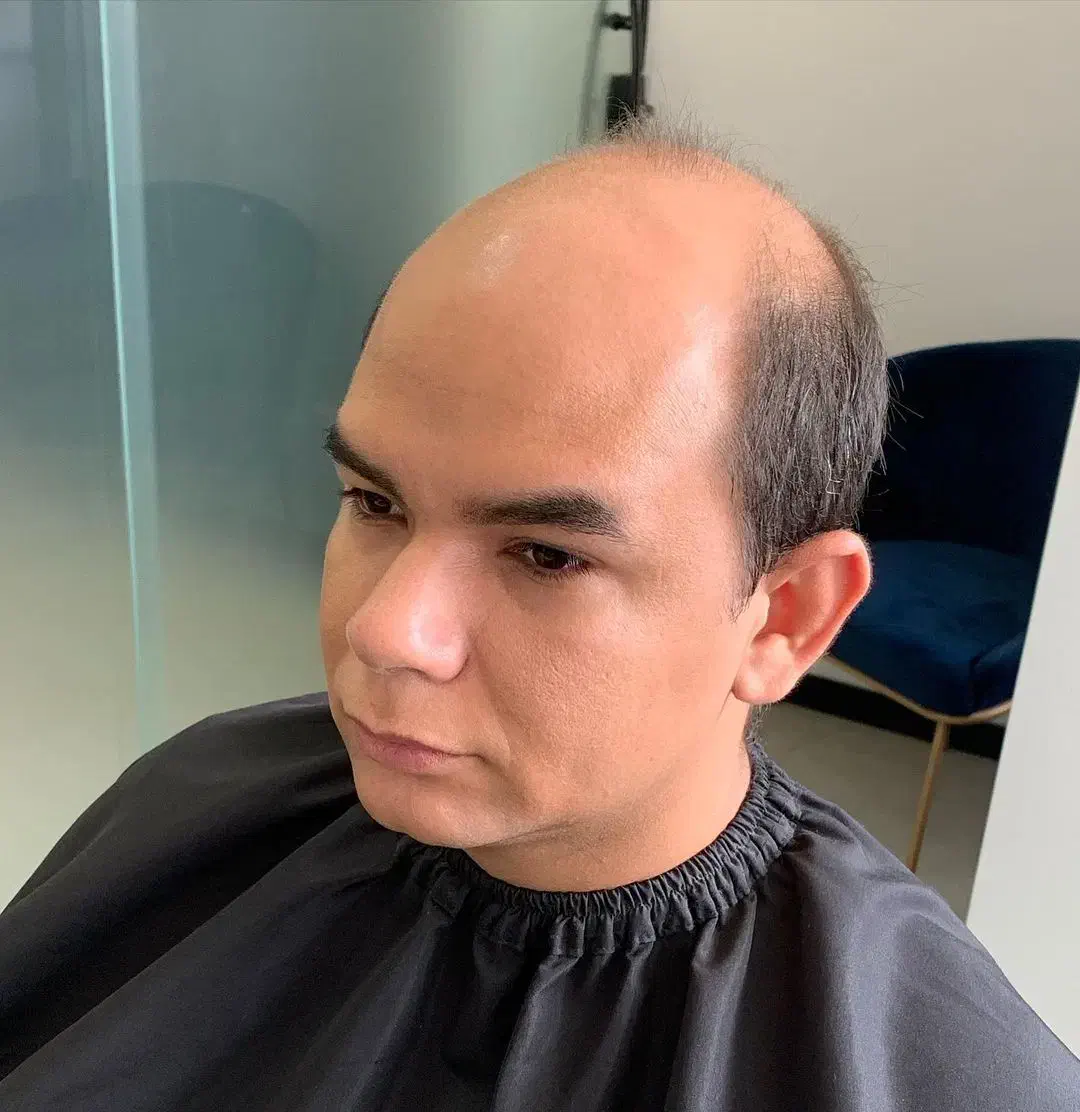 پروتز مو|خدمات آرایشگری و زیبایی|دهگلان, |دیوار