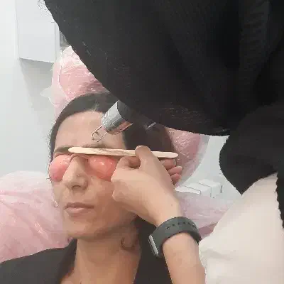 لیزر کیوسوئیچ (رفع لک صورت.رفع لک زیربغل.رفع تتو)|خدمات آرایشگری و زیبایی|رشت, پورسینا|دیوار