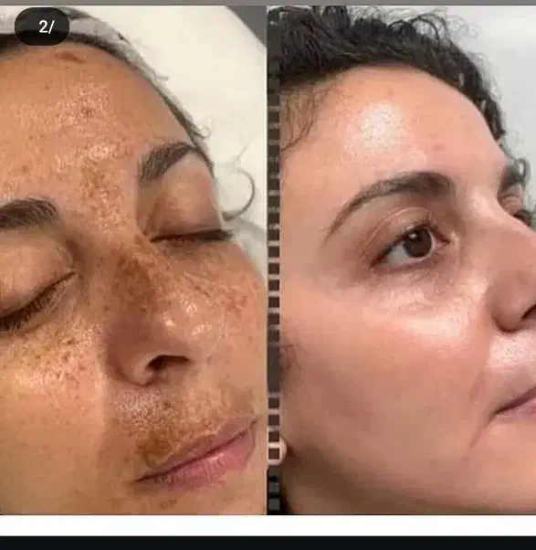 کرم معجزه صورت و کرم عربی دست و پا|آرایشی، بهداشتی، درمانی|داراب, |دیوار