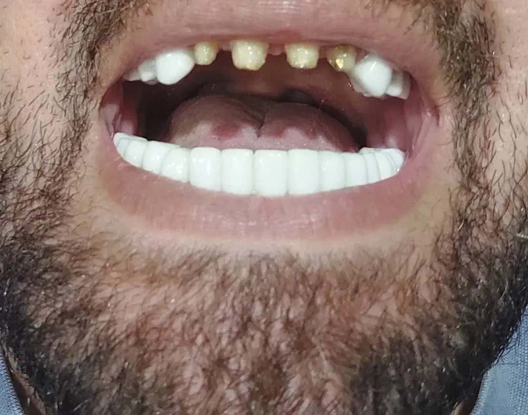 کلیه خدمات دندانپزشکی . زیبایی|خدمات آرایشگری و زیبایی|رشت, گلسار|دیوار