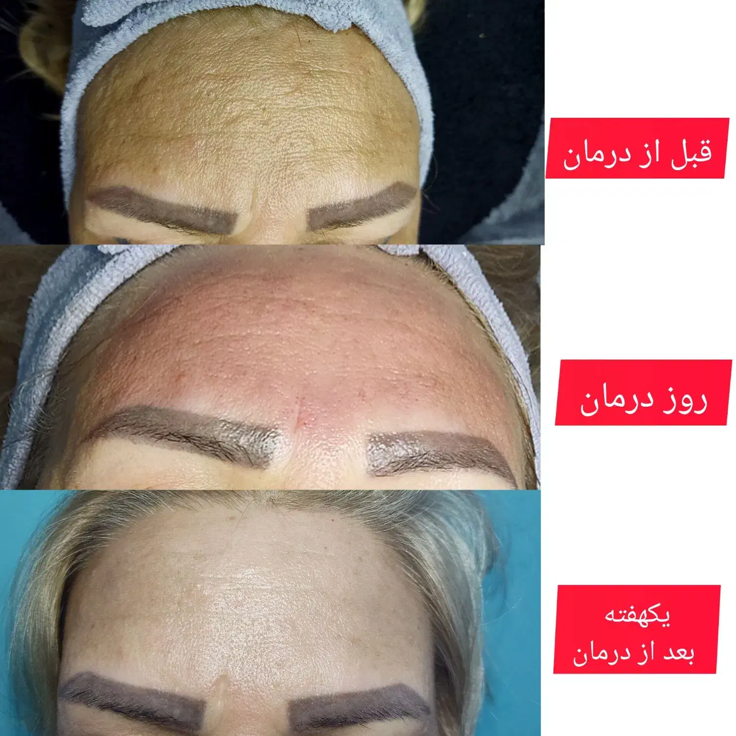 اولین اتاق پوست صومعه سرا با تراپی های درمانی|خدمات آرایشگری و زیبایی|صومعه‌سرا, |دیوار
