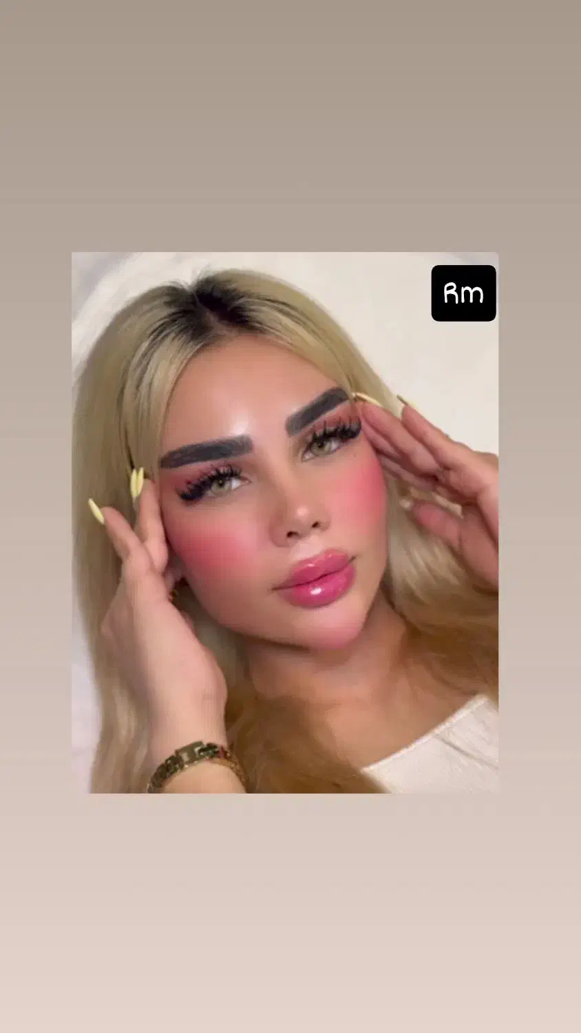 ۵۰ درصد تخفیف تزریق صورت سبک عربی هالیوودی لب روسی|خدمات آرایشگری و زیبایی|ری, دیلمان|دیوار